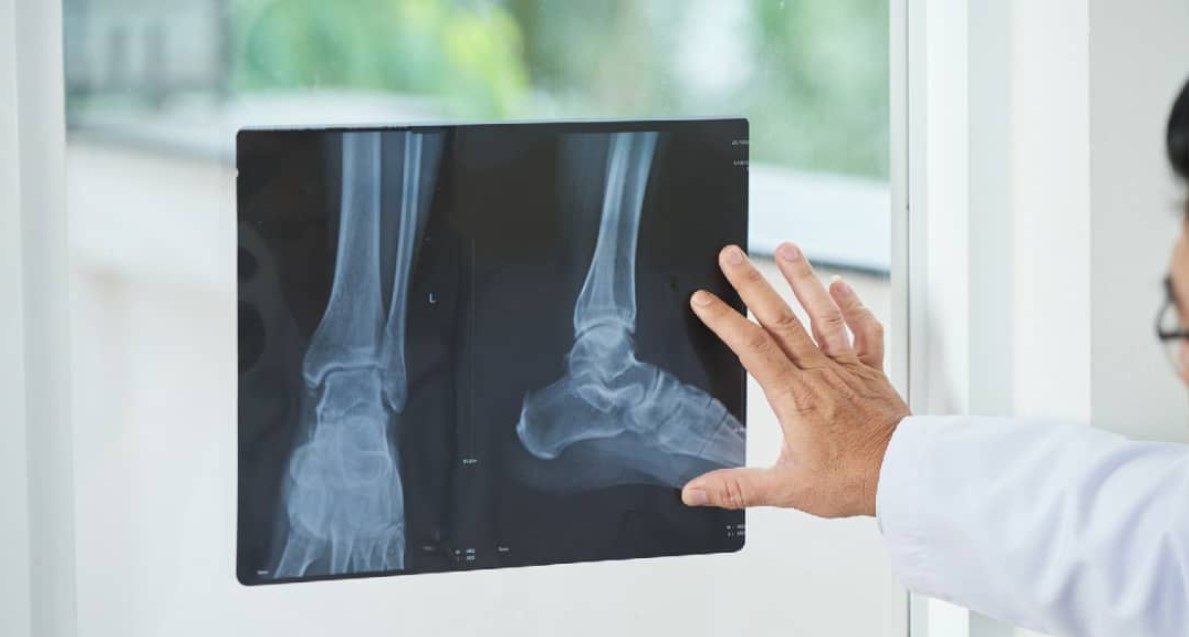 سلول های بنیادی استخوان